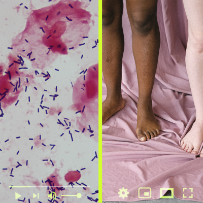 Chronic Vag Infections
